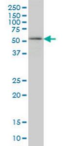 OXSR1 Monoclonal Antibody (4C12)