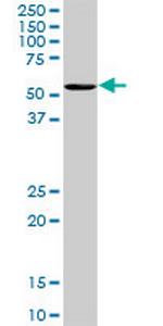 OXSR1 Monoclonal Antibody (2A5)