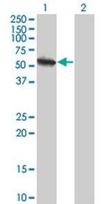 USP3 Monoclonal Antibody (1H2)