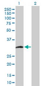 CCS Polyclonal Antibody, MaxPab™