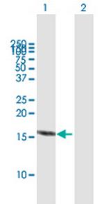 RBX1 Antibody in Western Blot (WB)