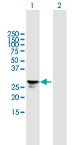 FGFBP1 Polyclonal Antibody, MaxPab™
