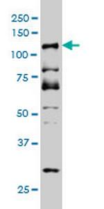 DMTF1 Monoclonal Antibody (5C6)