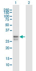 SCO2 Polyclonal Antibody, MaxPab™