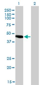 NR2E3 Monoclonal Antibody (2A12)
