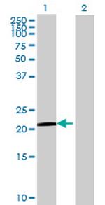 BCL2L10 Antibody in Western Blot (WB)
