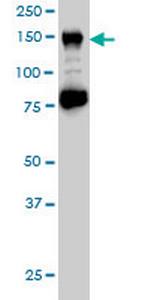 CHAF1A Monoclonal Antibody (1C2)