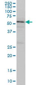 TOM1 Antibody in Western Blot (WB)