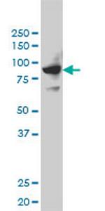 SH2D3C Monoclonal Antibody (3B2)