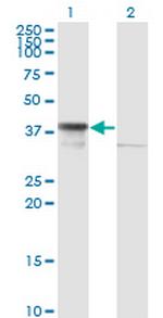 DNAJB6 Monoclonal Antibody (2D12-B9)