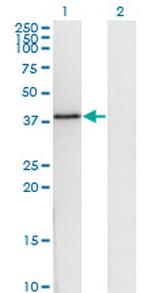 DNAJB6 Monoclonal Antibody (1A5)