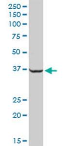 SAE1 Antibody in Western Blot (WB)