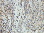 DNM1L Monoclonal Antibody (3B5)