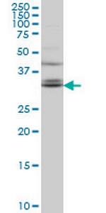 TSPAN32 Antibody in Western Blot (WB)