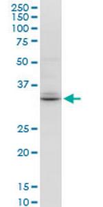 TSPAN32 Antibody in Western Blot (WB)