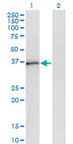 PQBP1 Monoclonal Antibody (1A11)