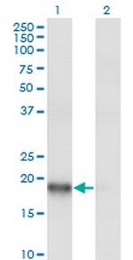 ARPC3 Monoclonal Antibody (2E11)