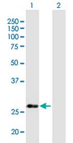 NUBP2 Polyclonal Antibody, MaxPab™
