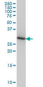 ARPC2 Antibody in Western Blot (WB)