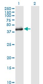 SGK2 Monoclonal Antibody (1A7)