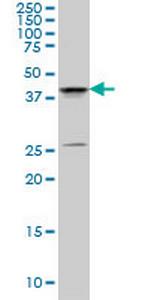 SGK2 Monoclonal Antibody (7A6)