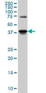 SGK2 Monoclonal Antibody (4B12)