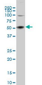 SGK2 Monoclonal Antibody (2F6)