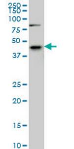 SGK2 Monoclonal Antibody (7C7)