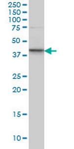 SGK2 Monoclonal Antibody (3D2)