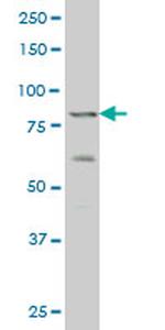 ZNF263 Antibody in Western Blot (WB)