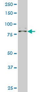ZNF263 Monoclonal Antibody (2G6)