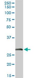 ELA3A Antibody in Western Blot (WB)