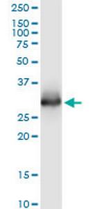 ELA3A Monoclonal Antibody (3G4)