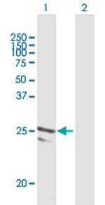 ARFRP1 Antibody in Western Blot (WB)