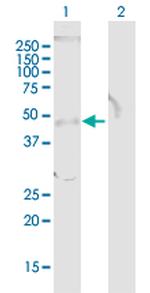 TOB1 Antibody in Western Blot (WB)