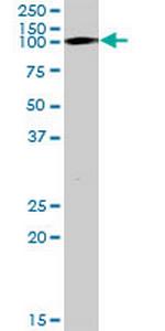 TRIM28 Antibody in Western Blot (WB)