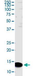 PDZK1IP1 Monoclonal Antibody (4D11)