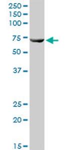 SLC25A13 Antibody in Western Blot (WB)