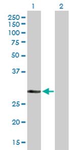 DHRS9 Polyclonal Antibody, MaxPab™