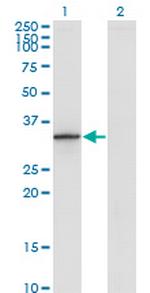 DHRS9 Monoclonal Antibody (3E3)