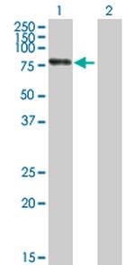 RBM6 Antibody in Western Blot (WB)