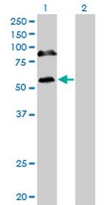 RBM6 Monoclonal Antibody (4B3)