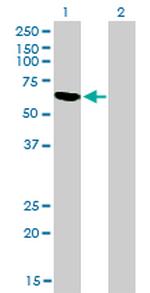 RBM5 Antibody in Western Blot (WB)