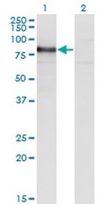 RBM5 Antibody in Western Blot (WB)