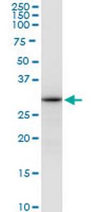 ALYREF Monoclonal Antibody (2G8)