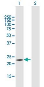TXNDC9 Polyclonal Antibody, MaxPab™