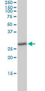 TXNDC9 Monoclonal Antibody (1E8-7C12)