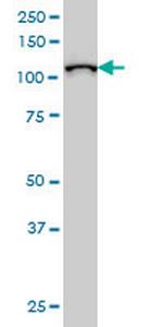 MPHOSPH10 Monoclonal Antibody (1B10)