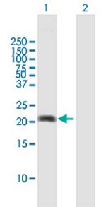 MPHOSPH6 Antibody in Western Blot (WB)