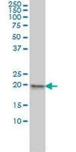 MPHOSPH6 Monoclonal Antibody (1D8-2A8)